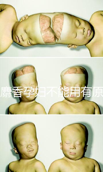 白麝香孕婦不能用有原因，流產、早產…這些危害不得不知