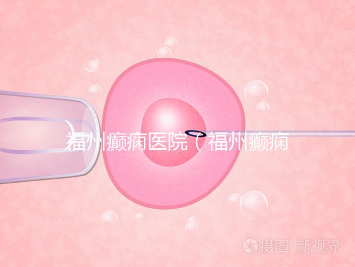 福州癲癇醫院（福州癲癇醫院在哪里）