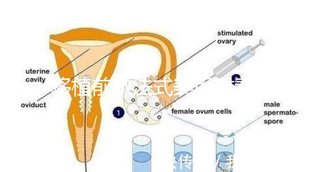 移植前做法式美甲對(duì)著床影響不少，別以為貼甲片就沒(méi)事了