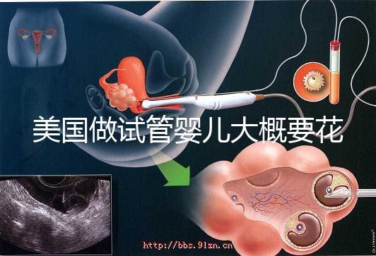 美國做試管嬰兒大概要花多少錢？具體支出25w！