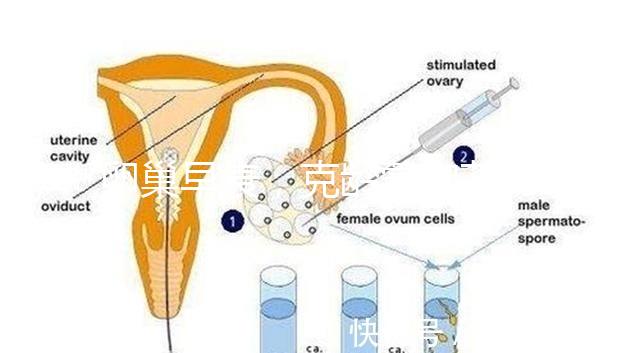 卵巢早衰，克齡蒙和芬嗎通藥物選擇引爭議