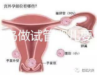 去青島做試管嬰兒要多少錢？