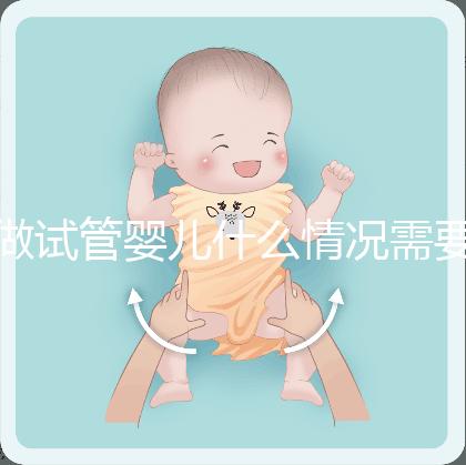 做試管嬰兒什么情況需要做染色體檢查？