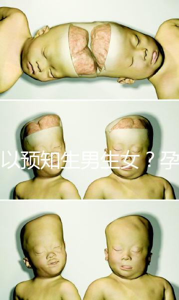 可以預知生男生女？孕婦夢見馬的胎夢解讀