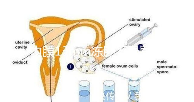 內膜13mm凍胚不易著床要注意，移植與否看醫生怎么說