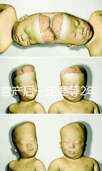 剖宮產(chǎn)后一定要等2年,才能試管嬰兒懷孕嗎?