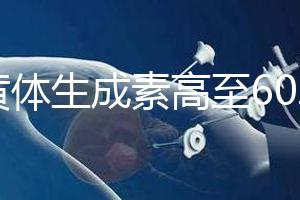 促黃體生成素高至60.48怎么辦?這3種方法可有效調理