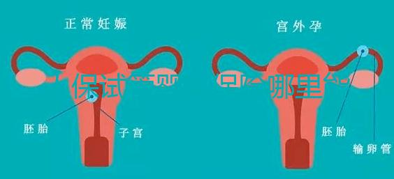 人保試管嬰兒保險哪里能買、怎么買速覽，一篇看懂不踩坑