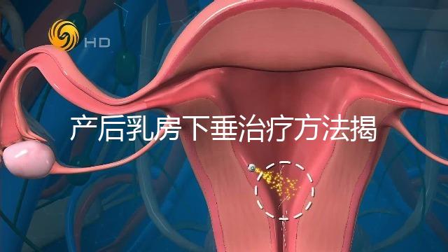 產(chǎn)后乳房下垂治療方法揭秘，按摩手法再好也沒提前預(yù)防有用