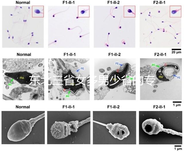 東北三省女多男少省的專業(yè)解讀原因1:1真沒(méi)開(kāi)玩笑