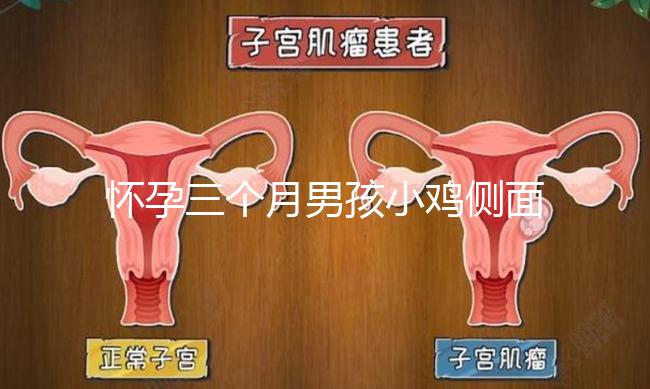 懷孕三個月男孩小雞側面二維b超圖片分享，原來兩腿間有尖