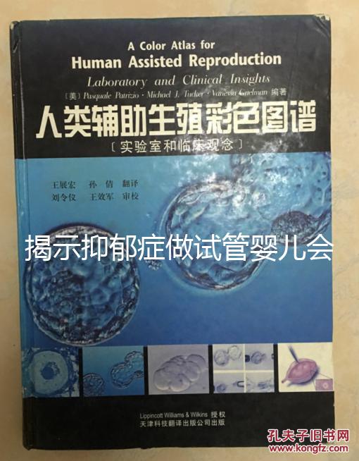 揭示抑郁癥做試管嬰兒會(huì)遺傳給女兒，想避免看這個(gè)