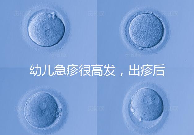 幼兒急疹很高發(fā),出疹后的護理方法及注意事項提前知曉!