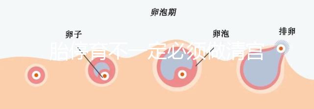 胎停育不一定必須做清宮！不滿足這3種情況,無需要刮宮
