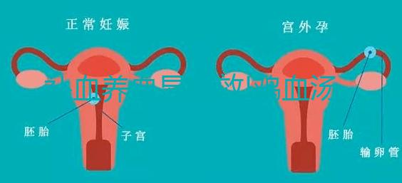 補血養(yǎng)血顯奇效!雞血湯常見的5大功效一覽