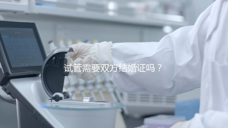 試管需要雙方結婚證嗎？試管是不是需要結婚證